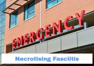 What Is Necrotising Fasciitis?
